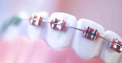 dental treatments